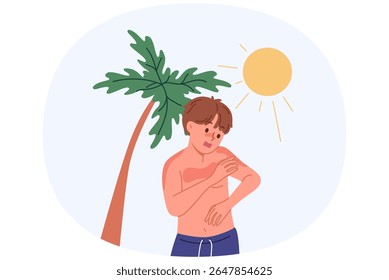 Rapaz recebeu queimadura de sol devido à alergia ultravioleta ou heliofobia, de pé na praia com palmeira. A falta de protetor solar causou queimadura solar em crianças que necessitavam de cuidados médicos ou pomada medicinal