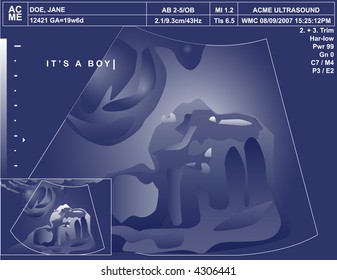 It's a boy! Vector illustration of blue-tinged ultrasound with the words "It's a boy" typed on top, as though by the ultrasound technician.