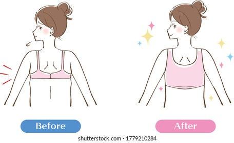 Bra armpit flesh bulge, before after illustration.