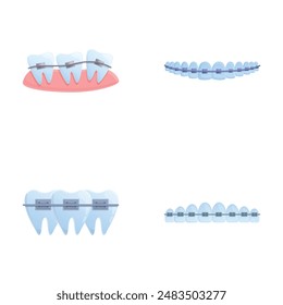 Brace system icons set cartoon vector. Orthodontic brace system on teeth. Orthodontic treatment, bite correction