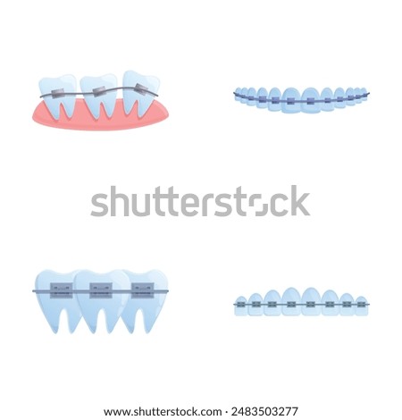 Brace system icons set cartoon vector. Orthodontic brace system on teeth. Orthodontic treatment, bite correction