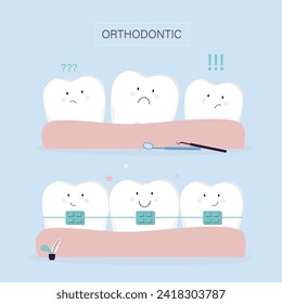 Brace tooth correction. Crooked teeth on the gum and straight teeth with braces. Concept of orthodontic treatment. Funny teeth in orthodontic braces. Oral care, healthcare. flat vector illustration