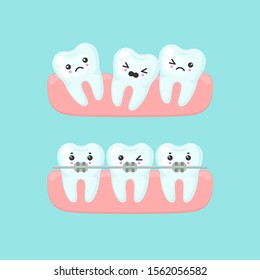 cartoon teeth with braces