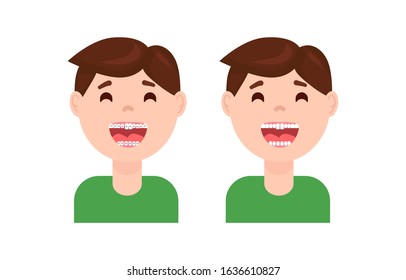 Braces dental treatment before and after. Cute cartoon boy with teeth braces. Smiling kids with a nice smile after wearing braces vector illustration