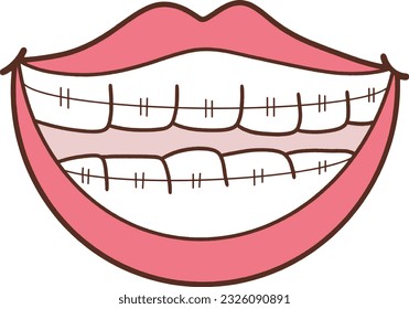 Brace el labio dental dental dental dental de dentista