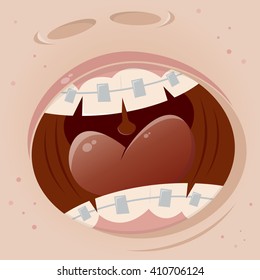 braces mouth cartoon funny clipart