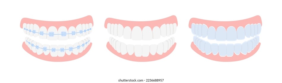 Braces, mouthguards, and aligners for correction jaw and teeth, isolated on white background. Concept dental medecine, stomatology. Cartoon flat design. Vector illustration.