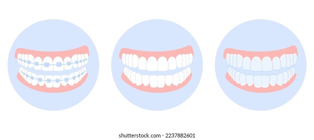 Braces, mouthguards, and aligners for correction jaw and teeth, in blue circles isolated on white background. Concept dental medecine, stomatology. Cartoon flat design. Vector illustration.