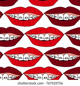 Braces on teeth vector illustration. Doodle style. Design, print, decor, textile, paper