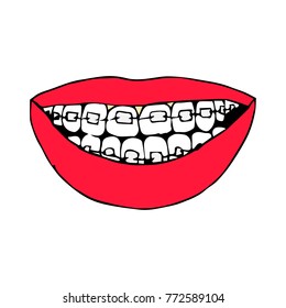 Braces on teeth vector illustration. Doodle style. Design, print, decor, textile, paper