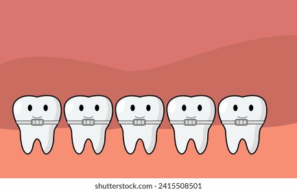 Braces are orthodontic devices made of metal or transparent material, placed on teeth to medically correct their alignment and shape