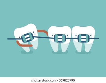 Braces teeth of dental healthcare ,dental concept