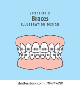 Braces teeth(full) illustration vector on blue background. Dental concept.