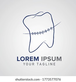 braces tooth teeth dent dentist dental medical vector icon as logo formation in blue bushed colors, Corporate design, vector design template on gray background. Vector illustration. Eps 10 vector file