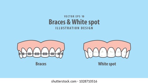 Braces & White spot illustration vector on blue background. Dental concept.