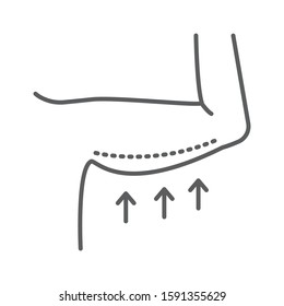 Brachioplasty black line icon. Arm lift concept. Plastic body surgery. Sign for web page, mobile app, banner, social media. Editable stroke.