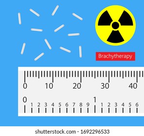 Brachytherapy Treat Vagina Cell CT Scan MRI Cervix Seed Radiotherapy Iodine Pelvic Episcleral Implant