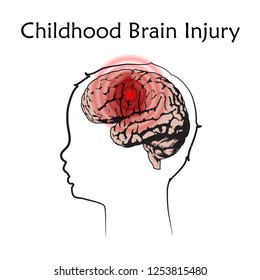 Braim injury in infants, childhood. Vector medical illustration. Kid, baby. White background, line silhouette of child head, anatomy flat image of damaged human brain.