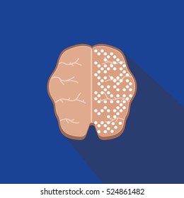 Brain anatomy