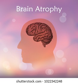 Brain atrophy. Blurred pink background. Silhouette of head.