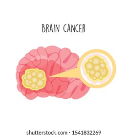 Brain Cancer flat vector illustration.
