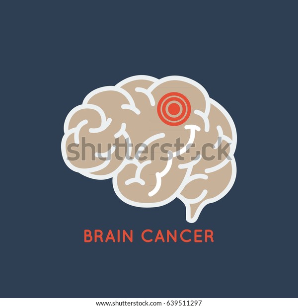 brain cancer