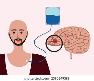 Brain cancer and mestasis, flat vector stock illustration with cancer patient, oncology concept