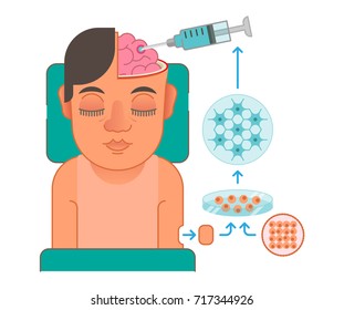 Brain Cells Transplantation Illustration