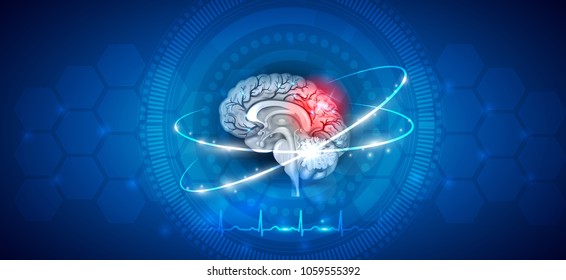 Brain Damage Treatment On Abstract Blue Stock Vector (Royalty Free ...