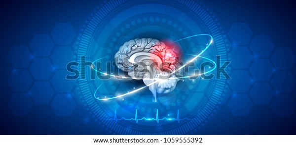 Brain Damage Treatment On Abstract Blue Stock Vector (Royalty Free ...