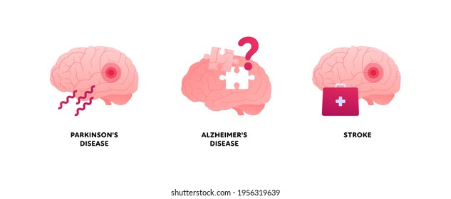 Brain disease concept. Vector flat illustration set. Parkinson, alzheimer and stroke attack illness icon. Health care neurology medical sign. Design element.