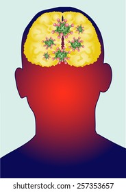 Brain has Infection Virus.