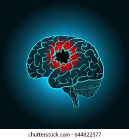 A brain with a hole, the concept of destruction of the brain, memory, stroke, serious illness and injury