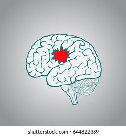 A brain with a hole, the concept of destruction of the brain, memory, stroke, serious illness and injury