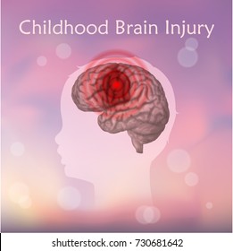 Brain Injury In Infants, Childhood. Vector Medical Illustration. Kid, Baby. Blurred Pink Background, Silhouette Of Child Head, Anatomy Image Of Damaged Human Brain.