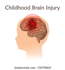 Brain Injury In Infants, Childhood. Vector Medical Illustration. Kid, Baby. White Background, Silhouette Of Child Head, Anatomy Image Of Damaged Human Brain.