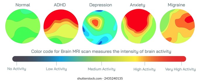 Brain MRI scan vector illustration. Magnetic resonance imaging is a medical imaging technique used in radiology to form pictures of the anatomy and the physiological processes inside the mind. 