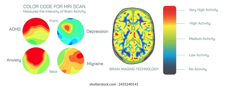 Brain MRI scan vector illustration. Magnetic resonance imaging is a medical imaging technique used in radiology to form pictures of the anatomy and the physiological processes inside the mind. 