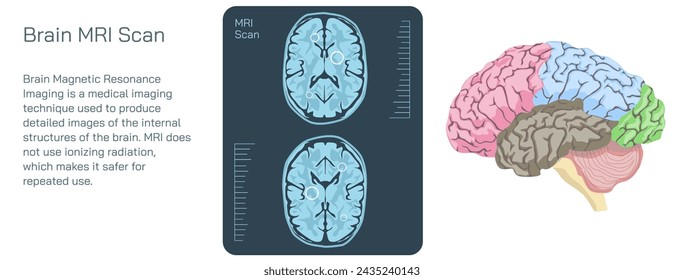 Brain MRI scan vector illustration. Magnetic resonance imaging is a medical imaging technique used in radiology to form pictures of the anatomy and the physiological processes inside the mind. 