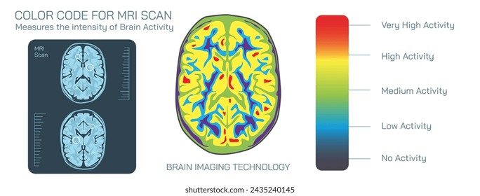 Brain MRI scan vector illustration. Magnetic resonance imaging is a medical imaging technique used in radiology to form pictures of the anatomy and the physiological processes inside the mind. 