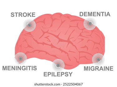 Trastornos neurológicos cerebrales. Ilustración vectorial