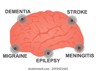 Brain neurological disorders. vector illustration