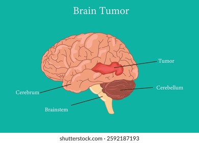 Brain problem. Malignant cells develop in the human brain. Human brain structure anatomy on green background. eps 10	