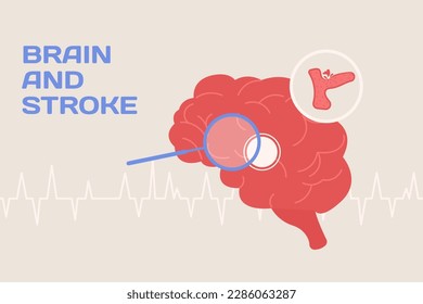 Brain and stroke concept illustration and poster in flat style