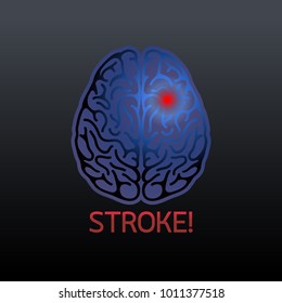 Brain Stroke Vector Illustrator