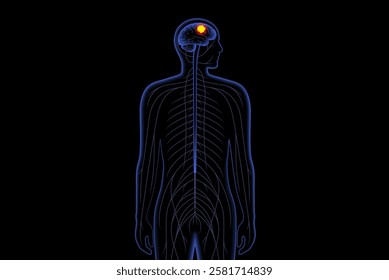 Brain tumor medical poster. Cancer, metastasis or benign in the human head or in the nerves, pituitary gland, pineal gland, and membranes that cover the surface of the brain 3D vector illustration