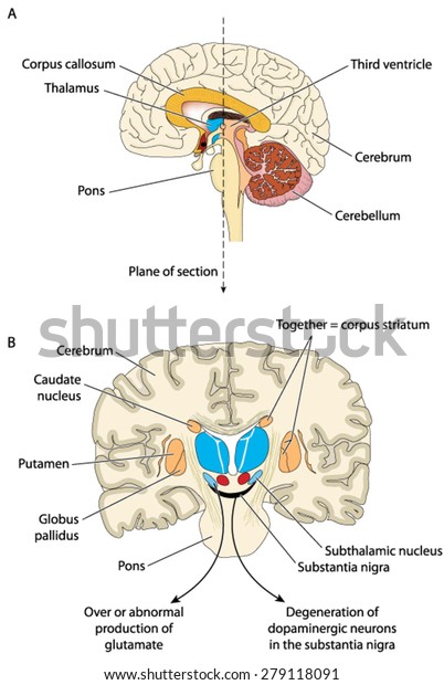 The brain in two places of section, showing the\
areas involved in the development of Parkinson\'s disease. Created\
in Adobe Illustrator.  EPS\
10.