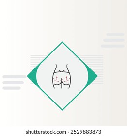 Brazilian Butt Lift (BBL) is a popular cosmetic procedure that enhances the shape and size of the buttocks using the patient’s own fat