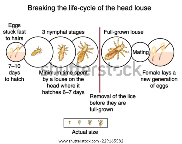 Breaking Life Cycle Head Louse By Stock Vector Royalty Free