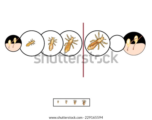 Breaking Life Cycle Head Louse By Stock Vector Royalty Free